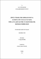 Küçük Resim