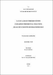 Küçük Resim