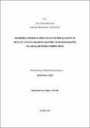 Küçük Resim